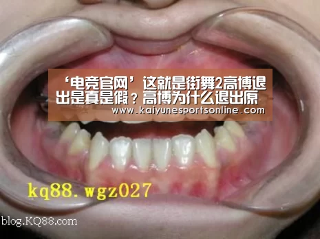 LOL直播